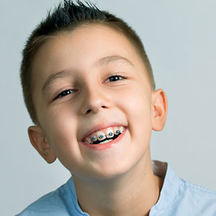 early orthodontic treatment